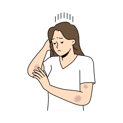 Гематома, синяк, ушиб