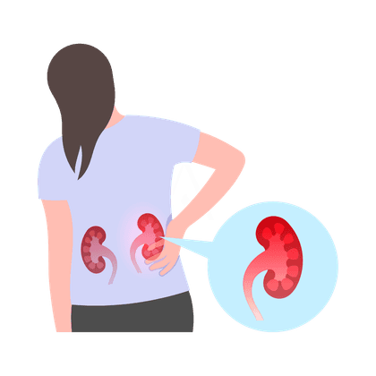 Мочекаменная болезнь (уролитиаз)