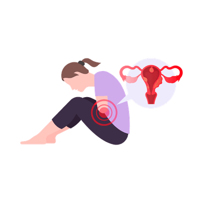 Миома матки